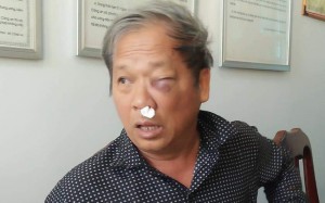 Nhà báo Hoàng Đình Chiểu bị hành hung dẫn tới nhiều thương tích